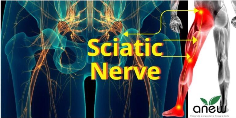Can Chiropractors Help Relieve Sciatic Nerve Pain?